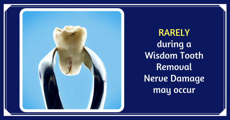 does-wisdom-teeth-removal-cause-nerve-damage-or-dental-paresthesia