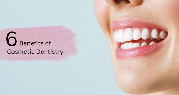 6 Benefits of Cosmetic Dentistry by Dr Sravanthi